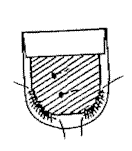 Patch Pockets