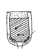 Patch Pockets